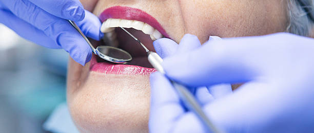 Best Emergency Wisdom Teeth Removal in Lauderhill, FL